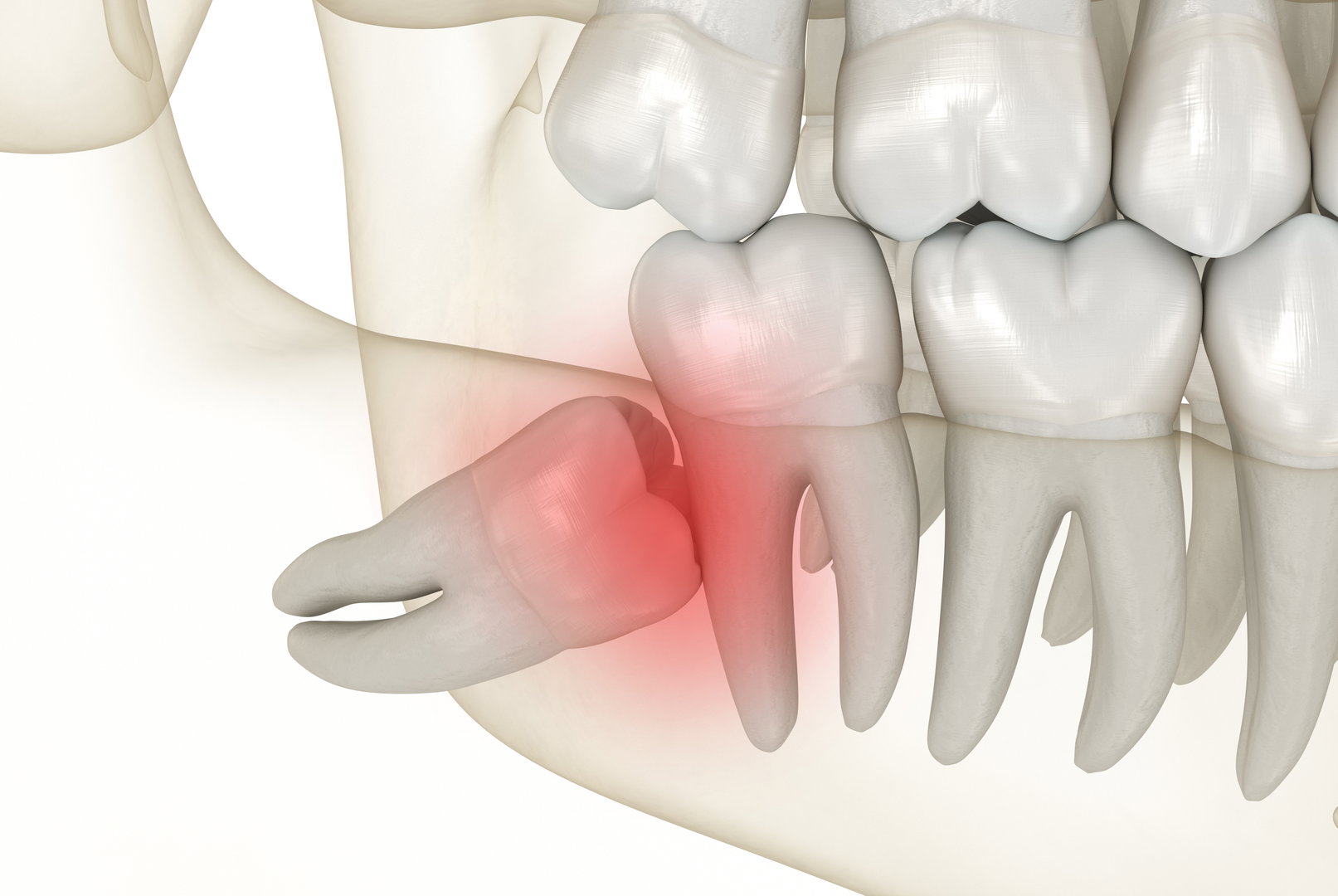 tooth-pain1