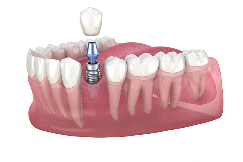Dentist in Milford