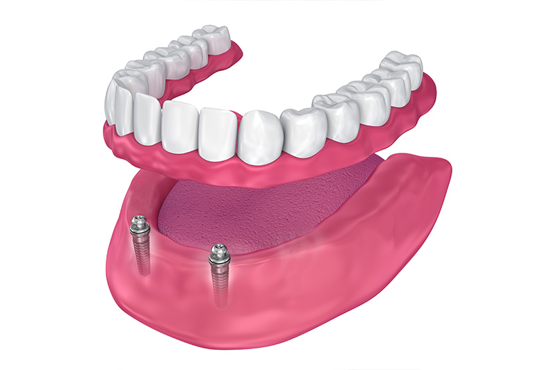 Dentist in Milford