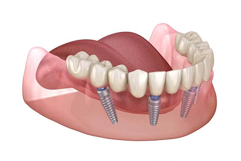 Dentist in Milford