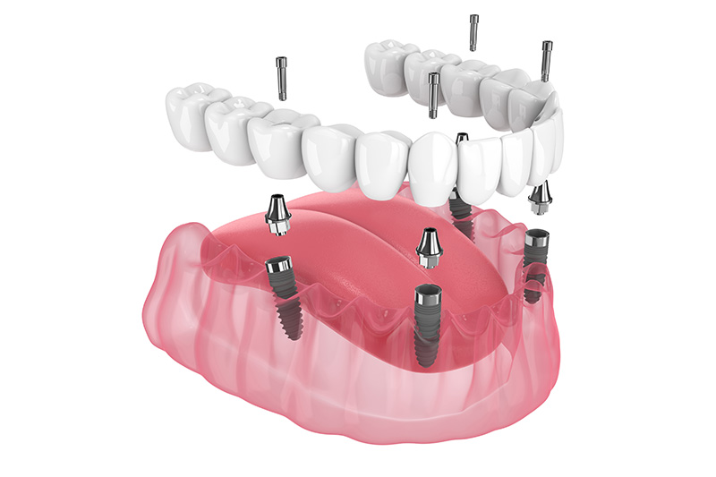 Dentist in Milford