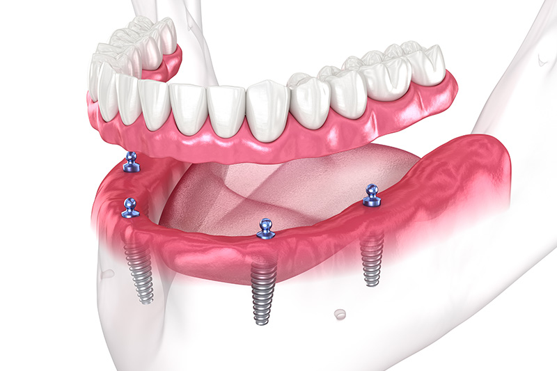 Dentist in Milford